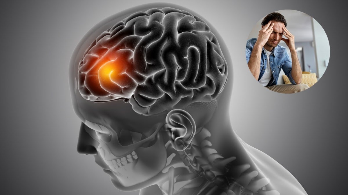 If your headache comes with these symptoms — don’t ignore it